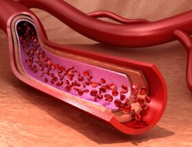 La disfunción endotelial es un proceso difícil de detectar pero con profundos efectos en personas con diabetes tipo 2.